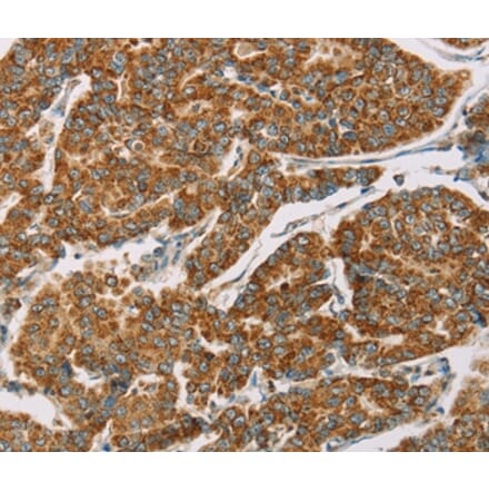 Immunohistochemistry - DLL4 Antibody from Signalway Antibody (36418) - Antibodies.com