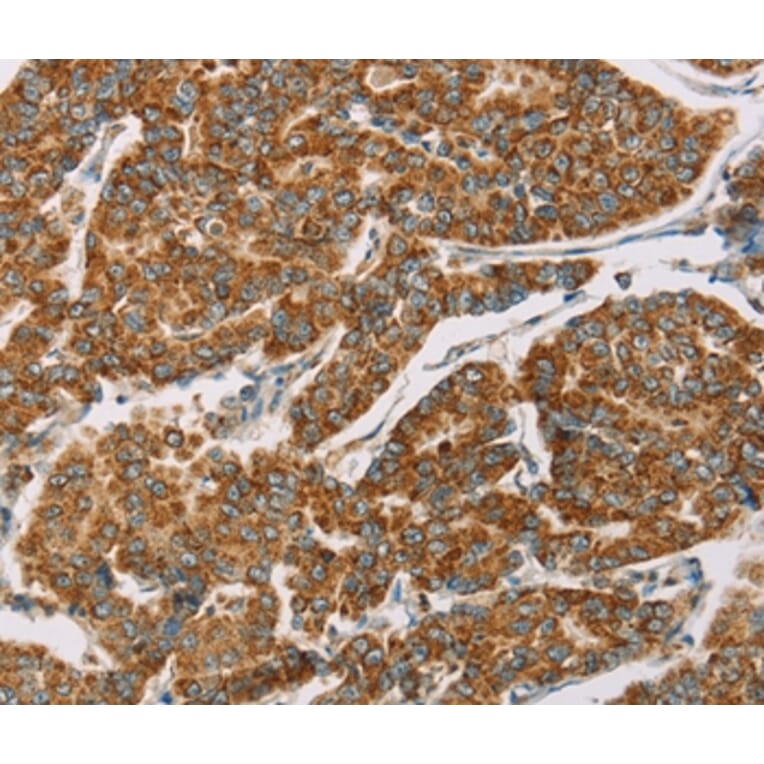 Immunohistochemistry - DLL4 Antibody from Signalway Antibody (36418) - Antibodies.com