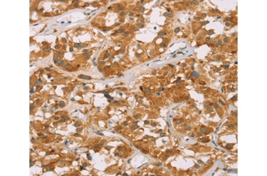 Immunohistochemistry - DLL4 Antibody from Signalway Antibody (36418) - Antibodies.com