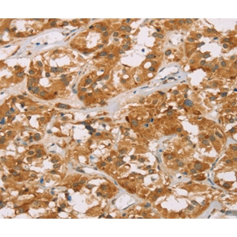 Immunohistochemistry - DLL4 Antibody from Signalway Antibody (36418) - Antibodies.com