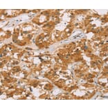Immunohistochemistry - DLL4 Antibody from Signalway Antibody (36418) - Antibodies.com