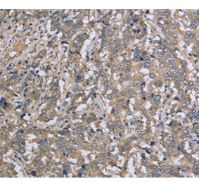 Immunohistochemistry - DTNB Antibody from Signalway Antibody (36425) - Antibodies.com