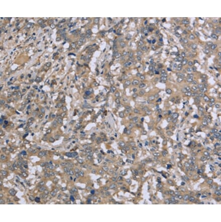 Immunohistochemistry - DTNB Antibody from Signalway Antibody (36425) - Antibodies.com