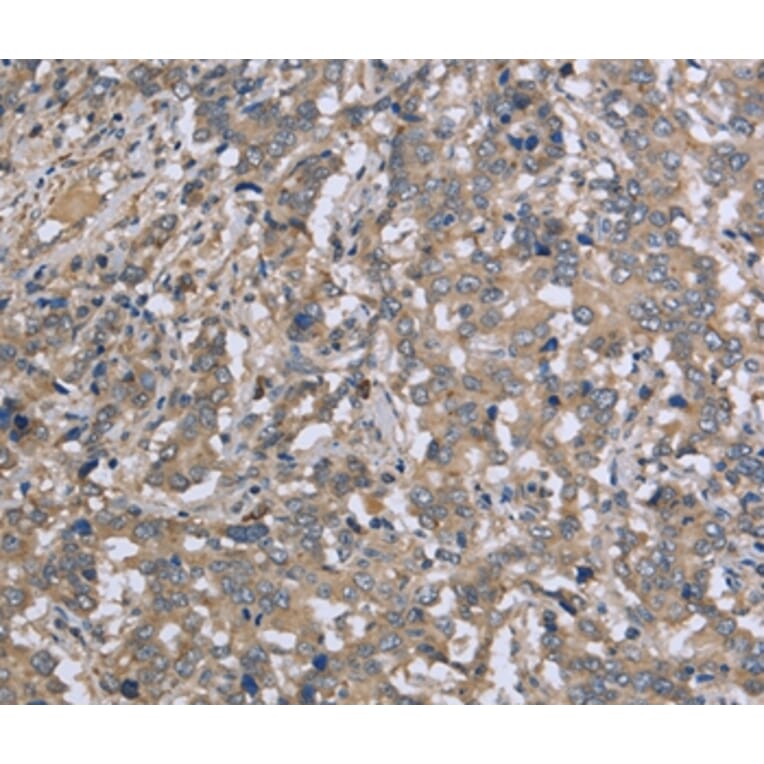 Immunohistochemistry - DTNB Antibody from Signalway Antibody (36425) - Antibodies.com