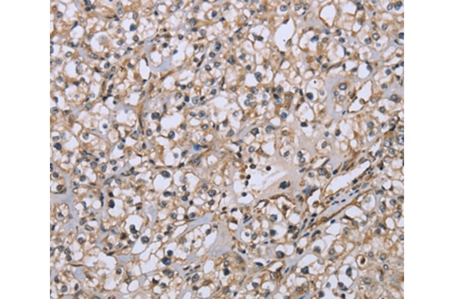 Immunohistochemistry - DTNB Antibody from Signalway Antibody (36425) - Antibodies.com