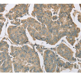 Immunohistochemistry - EIF5 Antibody from Signalway Antibody (36439) - Antibodies.com