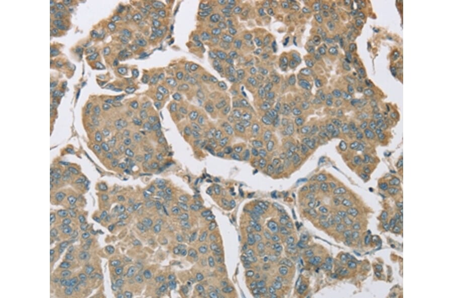 Immunohistochemistry - EIF5 Antibody from Signalway Antibody (36439) - Antibodies.com