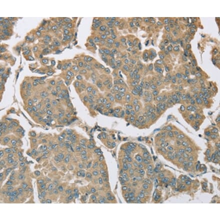 Immunohistochemistry - EIF5 Antibody from Signalway Antibody (36439) - Antibodies.com