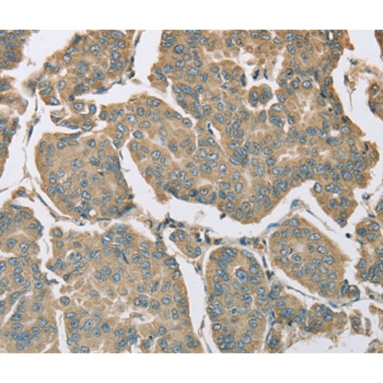 Immunohistochemistry - EIF5 Antibody from Signalway Antibody (36439) - Antibodies.com