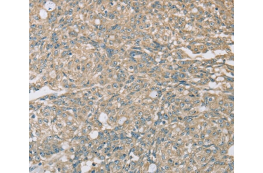 Immunohistochemistry - EIF5 Antibody from Signalway Antibody (36439) - Antibodies.com