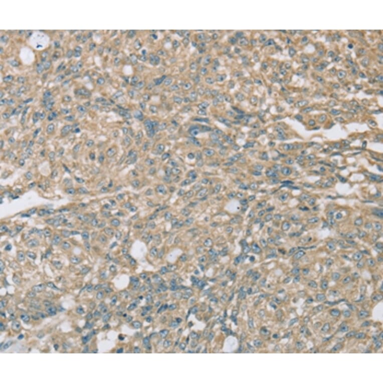 Immunohistochemistry - EIF5 Antibody from Signalway Antibody (36439) - Antibodies.com