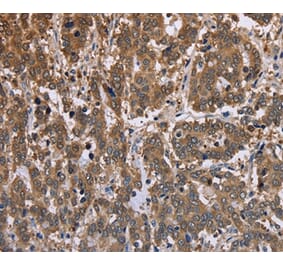 Immunohistochemistry - FBP2 Antibody from Signalway Antibody (36472) - Antibodies.com