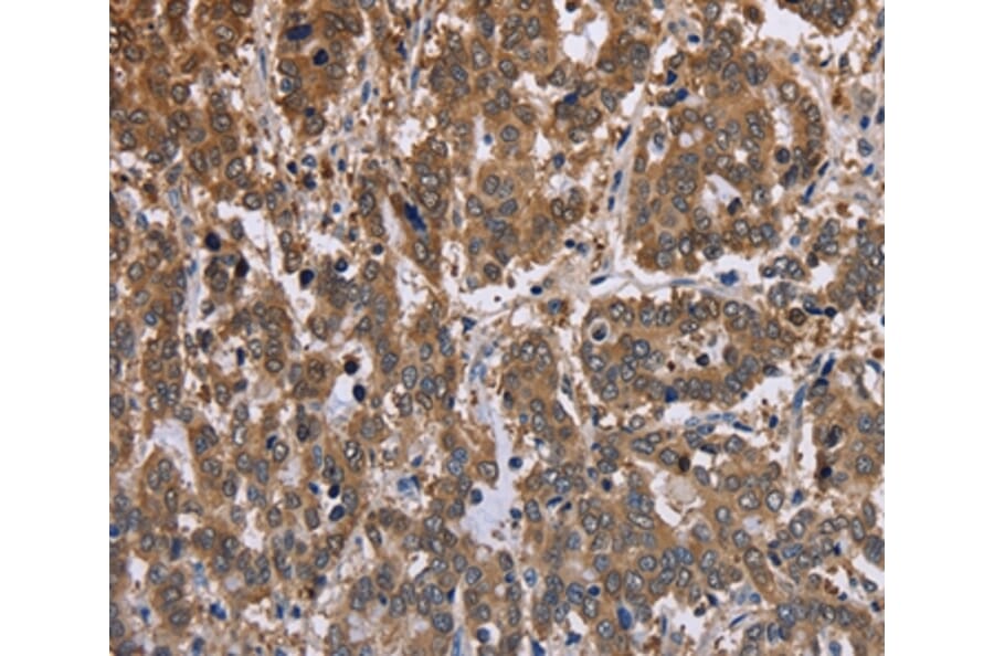 Immunohistochemistry - FBP2 Antibody from Signalway Antibody (36472) - Antibodies.com