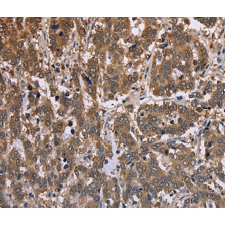 Immunohistochemistry - FBP2 Antibody from Signalway Antibody (36472) - Antibodies.com