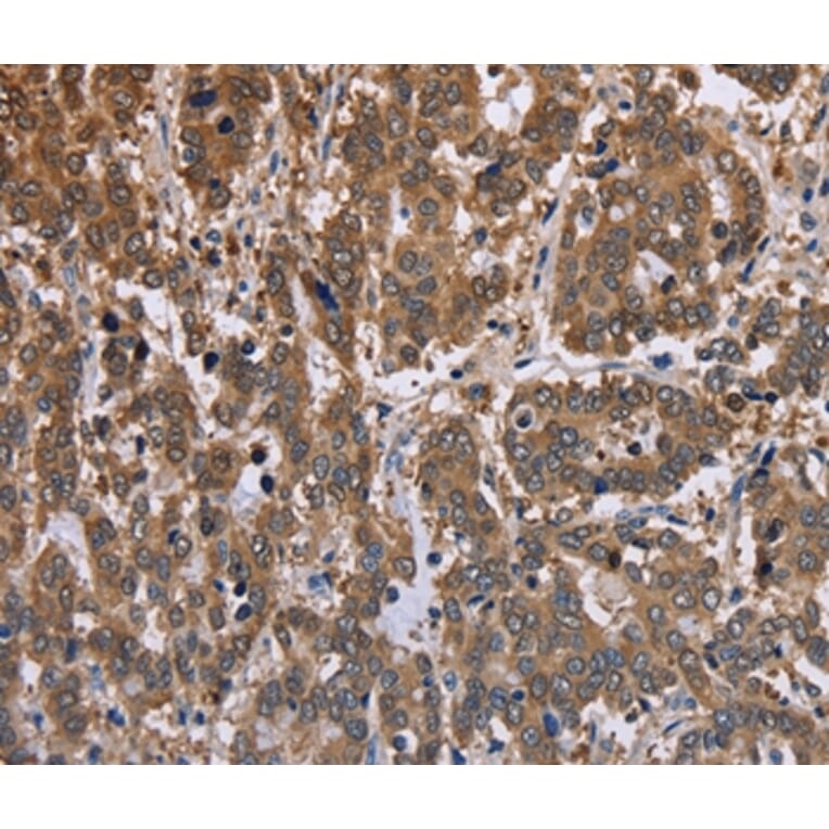 Immunohistochemistry - FBP2 Antibody from Signalway Antibody (36472) - Antibodies.com