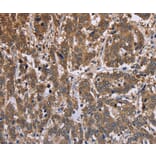 Immunohistochemistry - FBP2 Antibody from Signalway Antibody (36472) - Antibodies.com