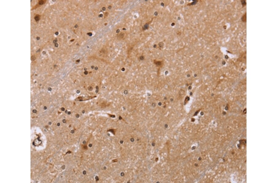 Immunohistochemistry - FBP2 Antibody from Signalway Antibody (36472) - Antibodies.com