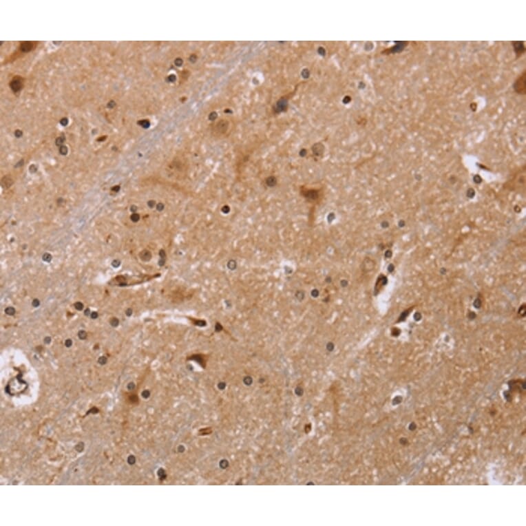 Immunohistochemistry - FBP2 Antibody from Signalway Antibody (36472) - Antibodies.com