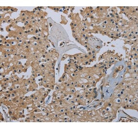 Immunohistochemistry - FLCN Antibody from Signalway Antibody (36486) - Antibodies.com