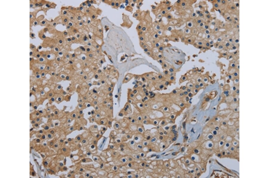Immunohistochemistry - FLCN Antibody from Signalway Antibody (36486) - Antibodies.com