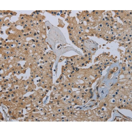 Immunohistochemistry - FLCN Antibody from Signalway Antibody (36486) - Antibodies.com
