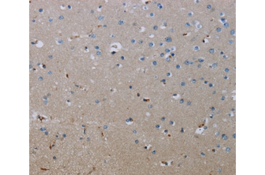 Immunohistochemistry - FLCN Antibody from Signalway Antibody (36486) - Antibodies.com