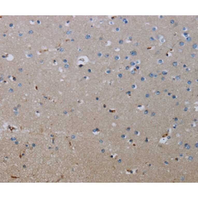 Immunohistochemistry - FLCN Antibody from Signalway Antibody (36486) - Antibodies.com