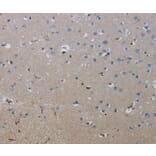 Immunohistochemistry - FLCN Antibody from Signalway Antibody (36486) - Antibodies.com