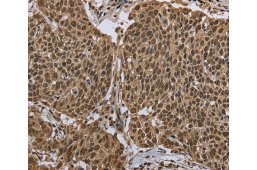Immunohistochemistry - PPAT Antibody from Signalway Antibody (36506) - Antibodies.com