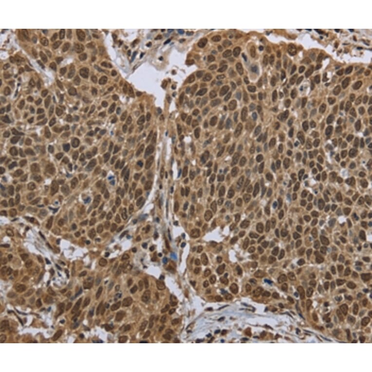 Immunohistochemistry - PPAT Antibody from Signalway Antibody (36506) - Antibodies.com