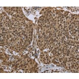 Immunohistochemistry - PPAT Antibody from Signalway Antibody (36506) - Antibodies.com