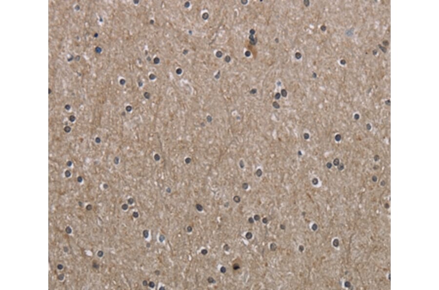 Immunohistochemistry - PPAT Antibody from Signalway Antibody (36506) - Antibodies.com