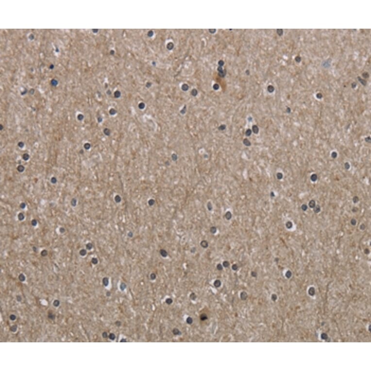 Immunohistochemistry - PPAT Antibody from Signalway Antibody (36506) - Antibodies.com