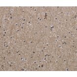 Immunohistochemistry - PPAT Antibody from Signalway Antibody (36506) - Antibodies.com
