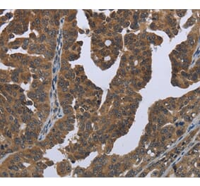 Immunohistochemistry - GYS2 Antibody from Signalway Antibody (36509) - Antibodies.com