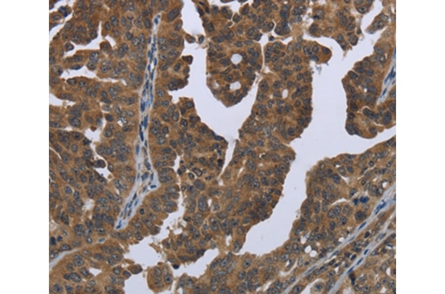 Immunohistochemistry - GYS2 Antibody from Signalway Antibody (36509) - Antibodies.com