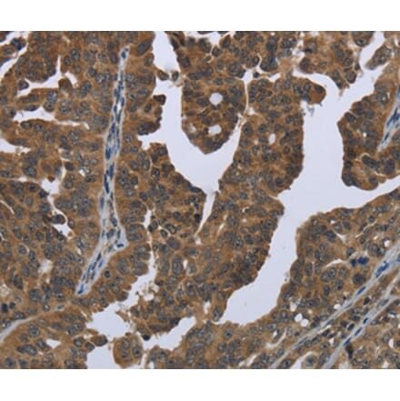 Immunohistochemistry - GYS2 Antibody from Signalway Antibody (36509) - Antibodies.com