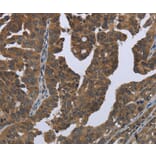 Immunohistochemistry - GYS2 Antibody from Signalway Antibody (36509) - Antibodies.com