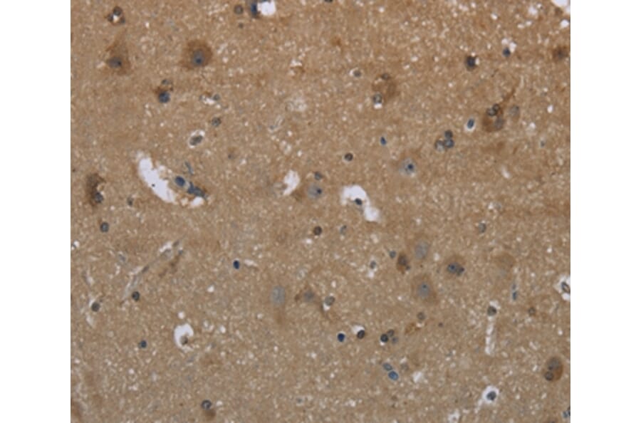 Immunohistochemistry - GYS2 Antibody from Signalway Antibody (36509) - Antibodies.com