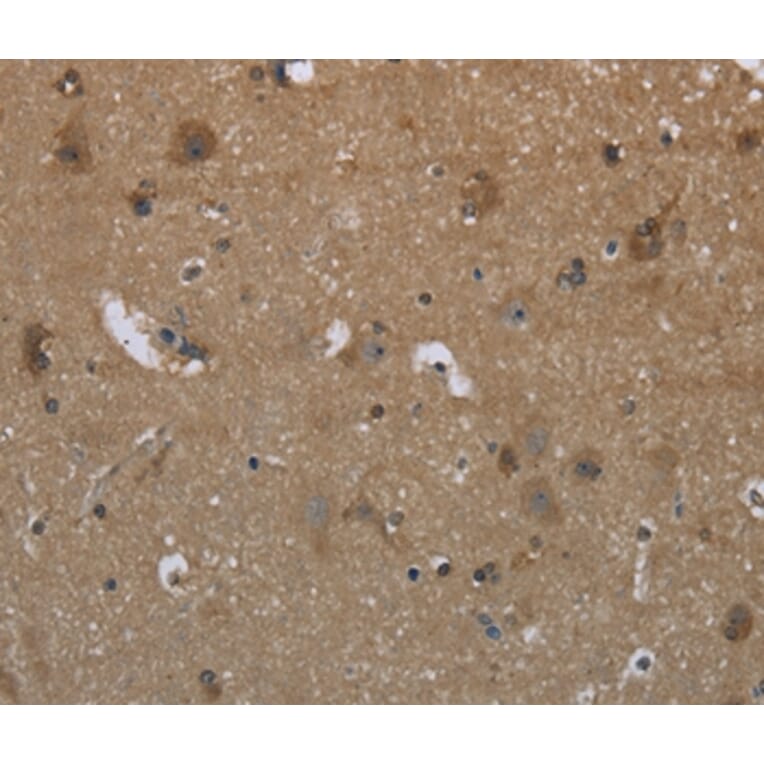 Immunohistochemistry - GYS2 Antibody from Signalway Antibody (36509) - Antibodies.com