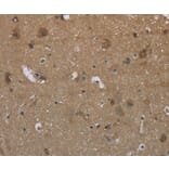 Immunohistochemistry - GYS2 Antibody from Signalway Antibody (36509) - Antibodies.com