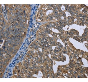 Immunohistochemistry - GPAM Antibody from Signalway Antibody (36513) - Antibodies.com