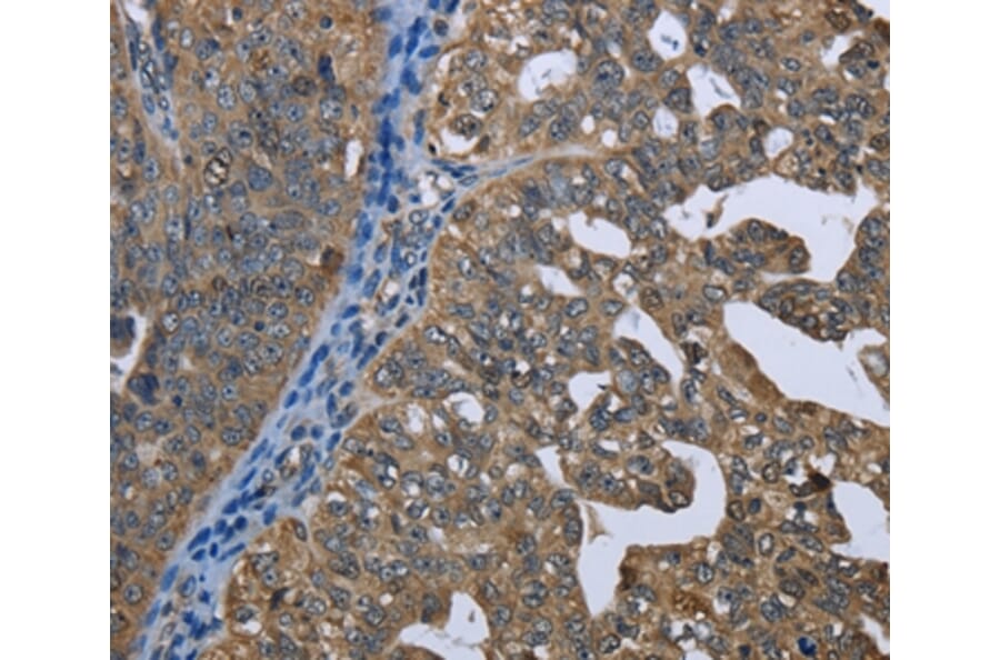 Immunohistochemistry - GPAM Antibody from Signalway Antibody (36513) - Antibodies.com