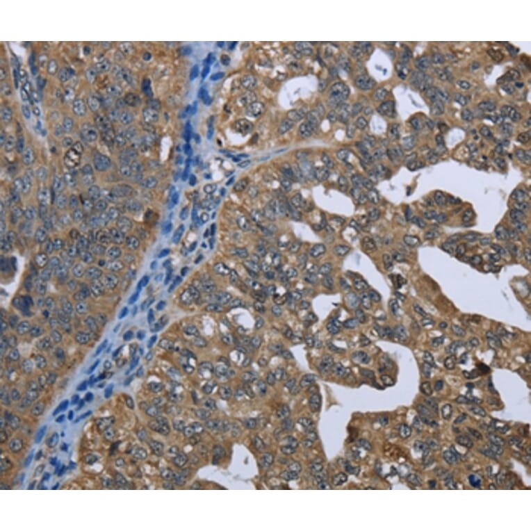 Immunohistochemistry - GPAM Antibody from Signalway Antibody (36513) - Antibodies.com