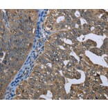 Immunohistochemistry - GPAM Antibody from Signalway Antibody (36513) - Antibodies.com