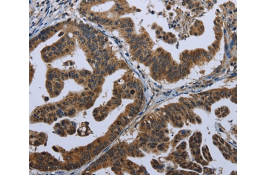 Immunohistochemistry - GPAM Antibody from Signalway Antibody (36513) - Antibodies.com