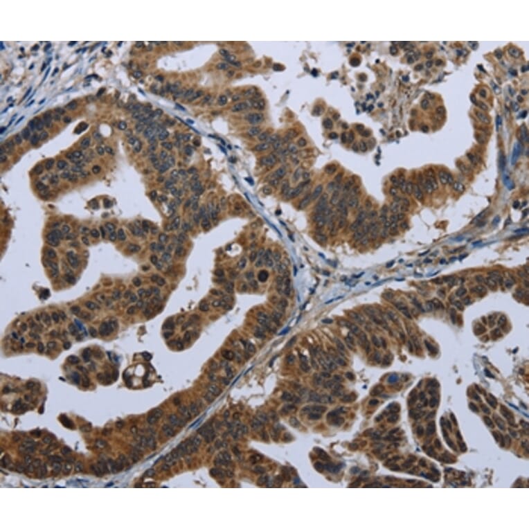 Immunohistochemistry - GPAM Antibody from Signalway Antibody (36513) - Antibodies.com