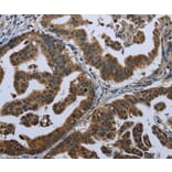 Immunohistochemistry - GPAM Antibody from Signalway Antibody (36513) - Antibodies.com