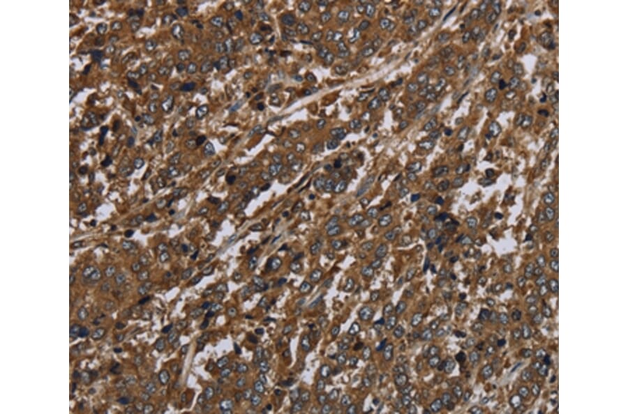 Immunohistochemistry - HPGD Antibody from Signalway Antibody (36526) - Antibodies.com