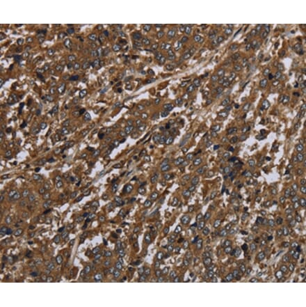Immunohistochemistry - HPGD Antibody from Signalway Antibody (36526) - Antibodies.com